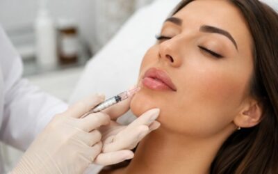 Filler labbra: quanto dura, come si fa e cosa aspettarsi dal trattamento